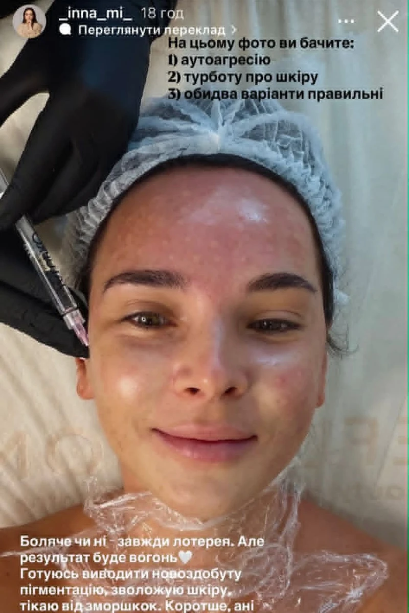 Інна Мірошниченко у косметолога на уколах краси