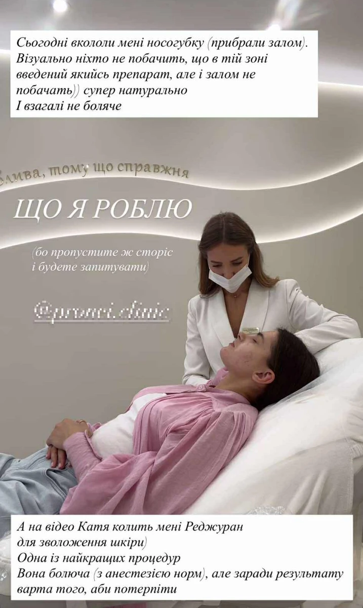 Остапчук прибирає залом у зоні носогубки 