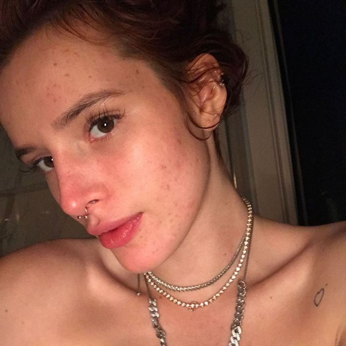 У 2017 році вона відверто показала у Instagram, як лікує своє обличчя і який має вигляд без макіяжу 