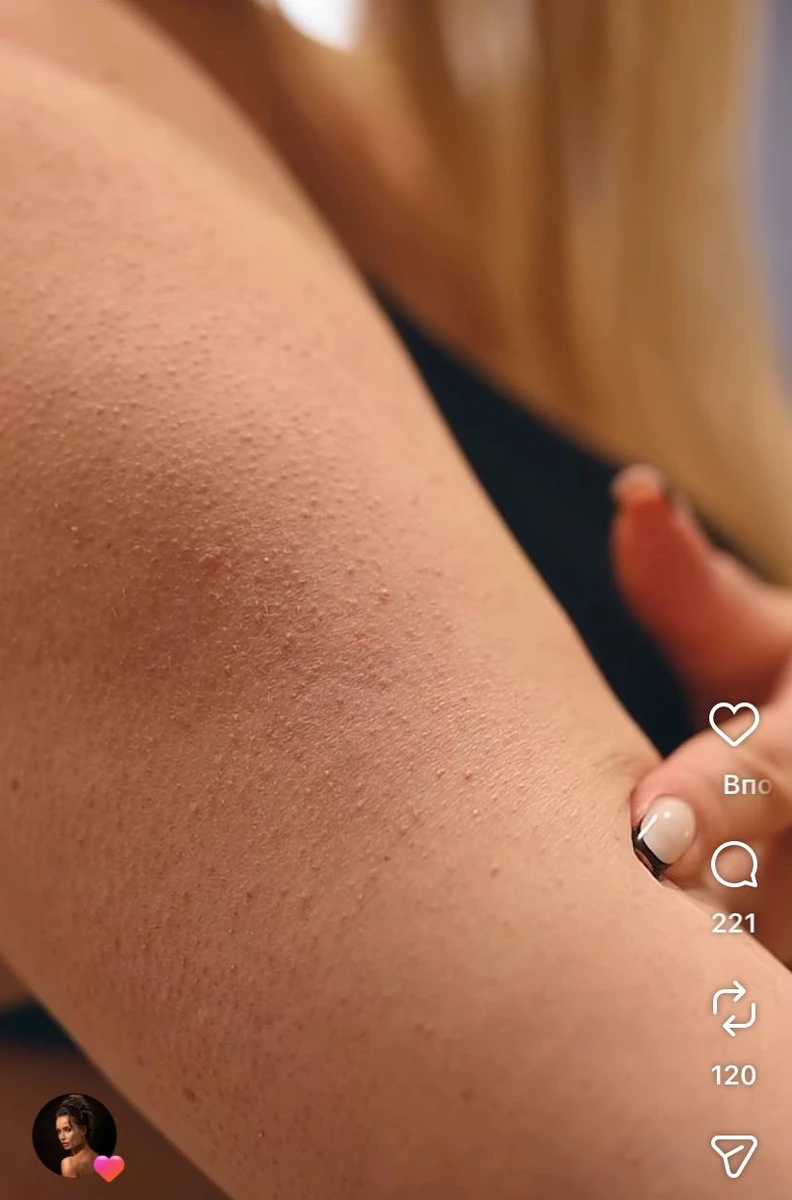 Інна Бєлєнь показала, як вагітність змінила її тіло