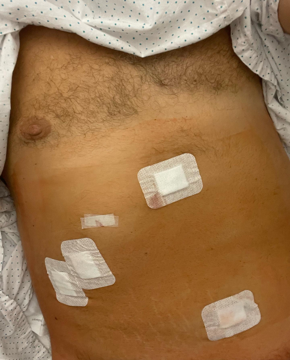 Потап переніс операцію - фото