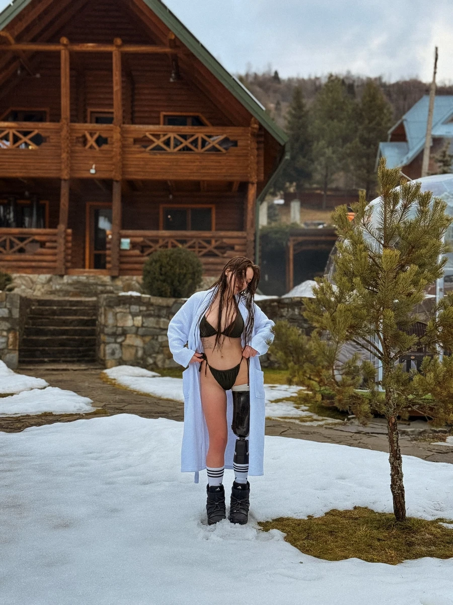 Руслана зізналася, що коли після протезування вона приїхала в Ізраїль, то першим її завданням було піти на пляж, де сотні людей, і скупатися в морі в купальнику.  Щоб звикнути до нової себе і до поглядів людей. Тепер вона вже часто знімається у бікіні і демонструє своє тіло в мережі 