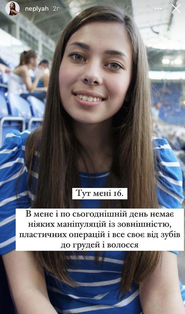 Судячи з фото у 16 років, Аня справді нічого не міняла у своєму лиці