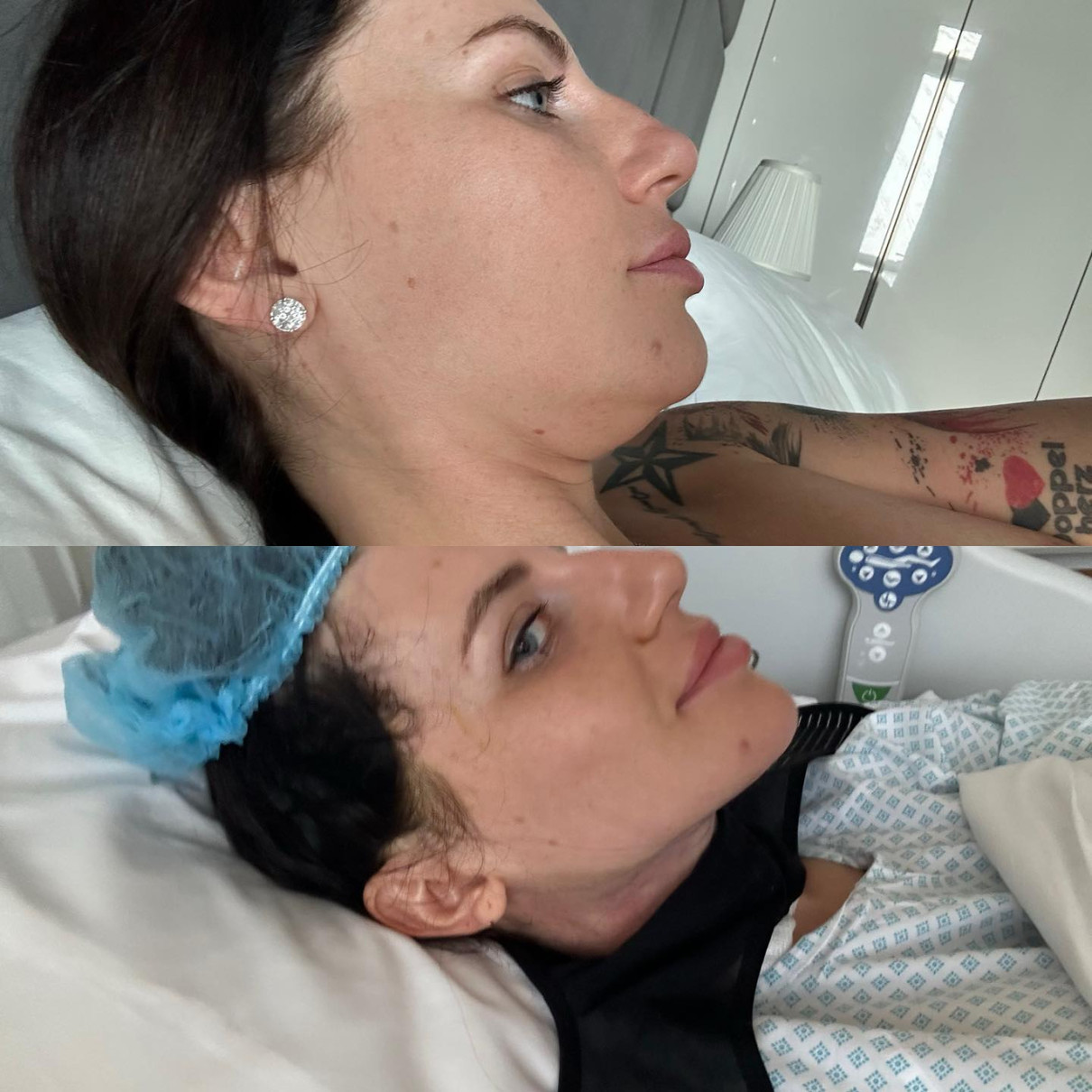 До та після операцї