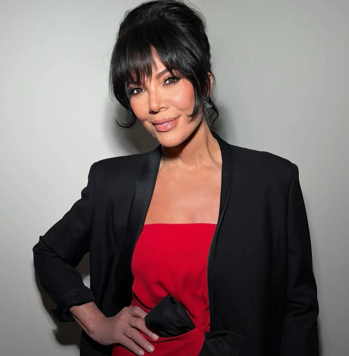 Кріс Дженнер планує ще одну пластичну операцію