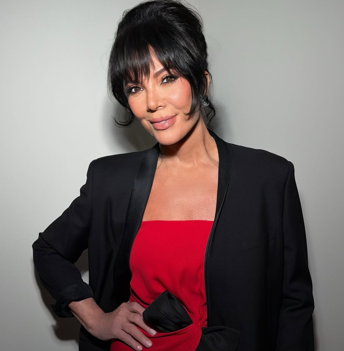 Кріс Дженнер планує ще одну пластичну операцію