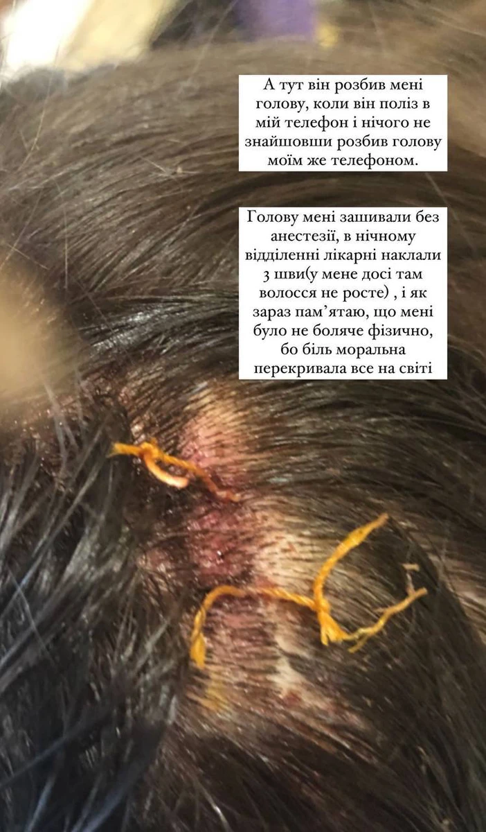 Доходило навіть до такого...