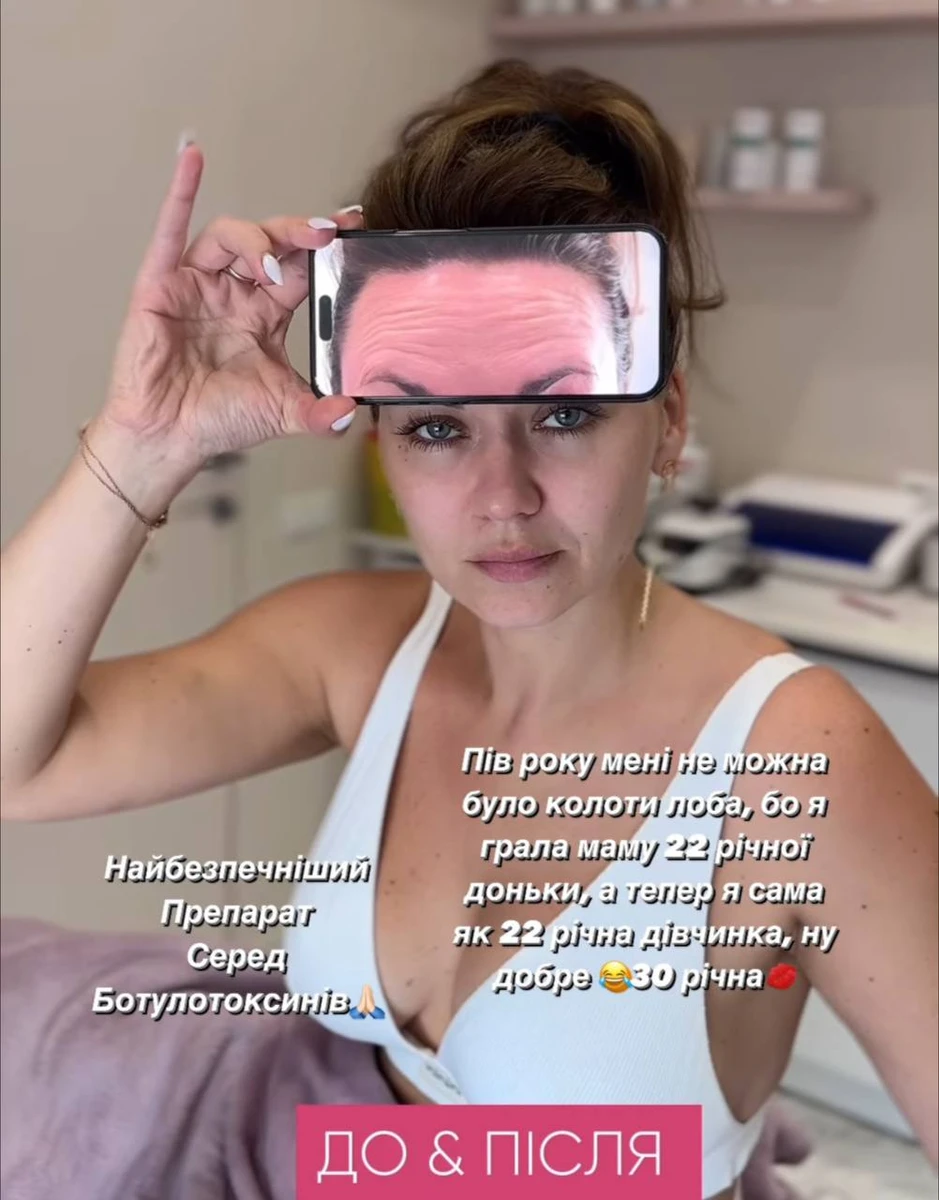 Саліванчук показала лоб до уколів ксеоміном