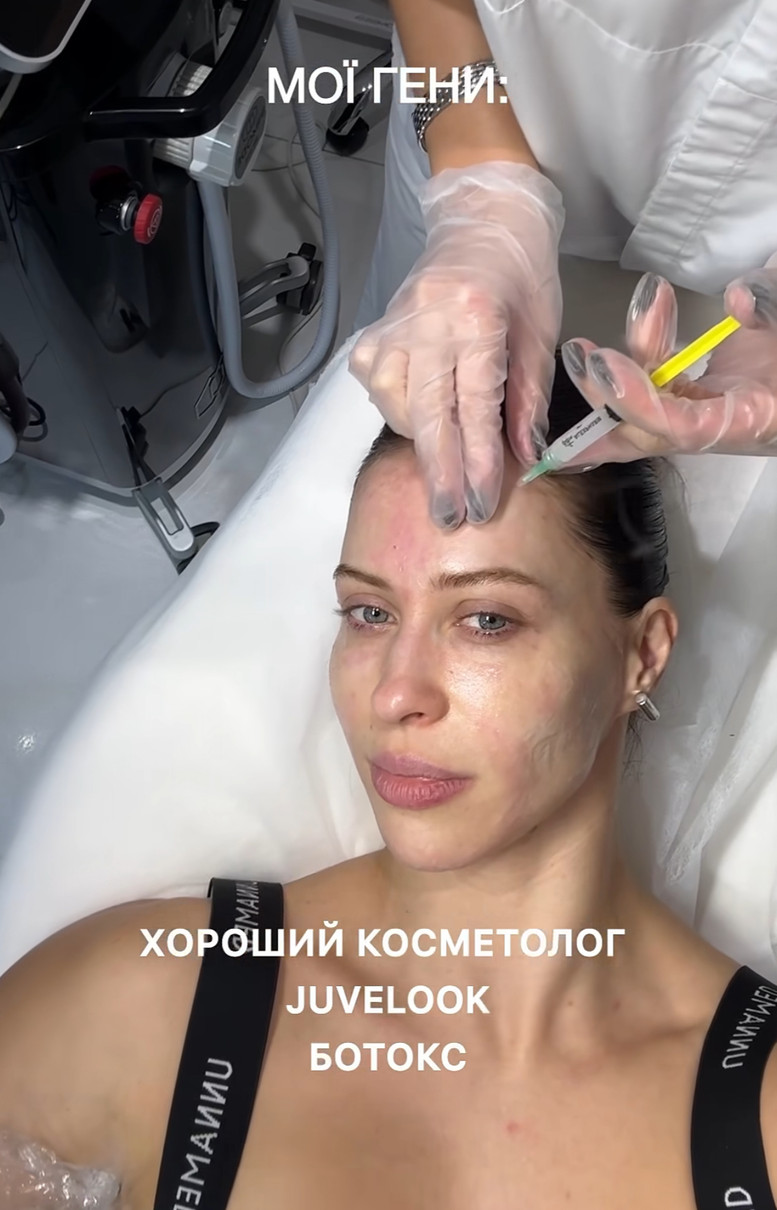 Вікторія Маремуха показалася у косметолога і розповіла про процедури, які робить