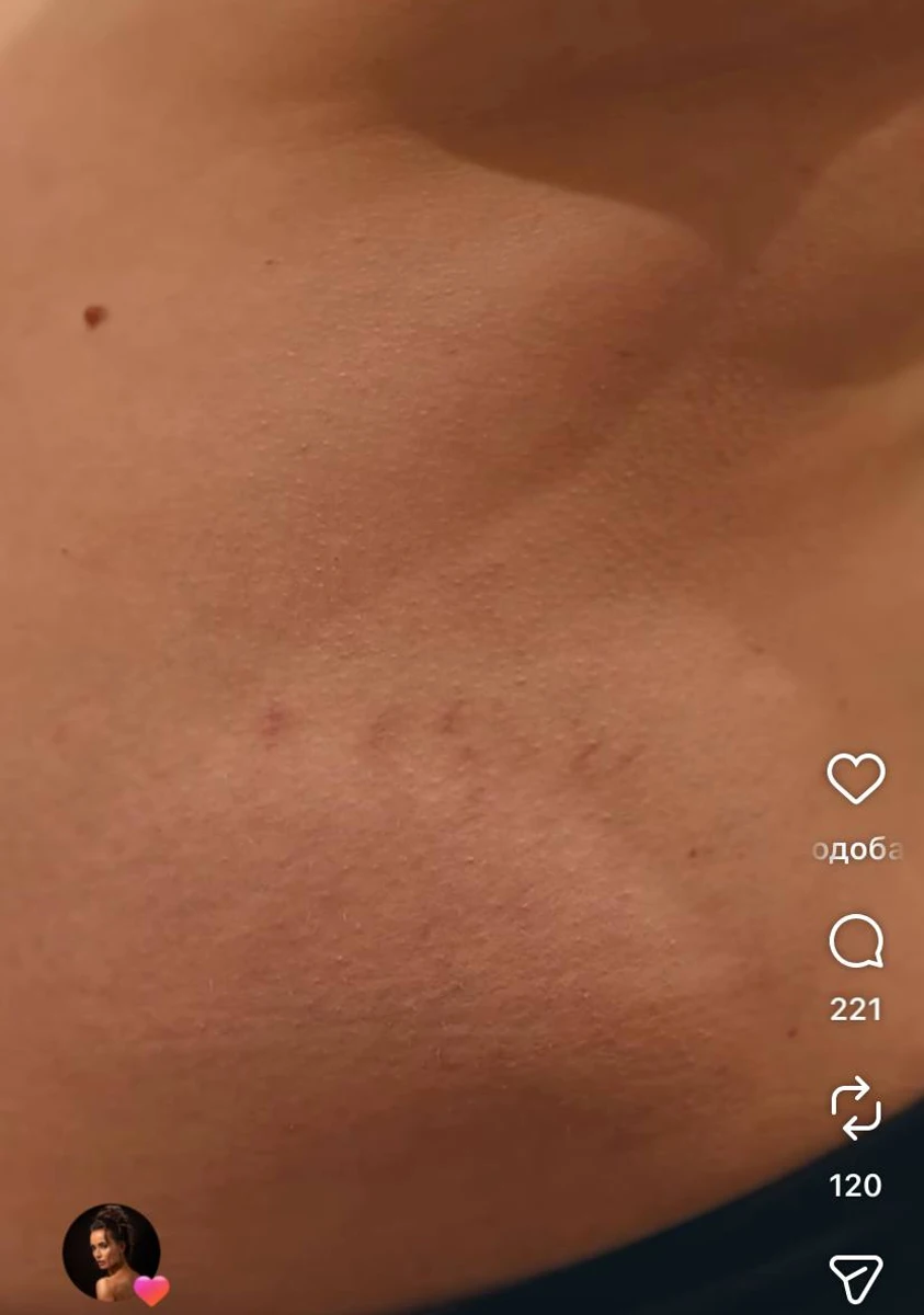 Інна Бєлєнь показала розтяжки під час вагітності