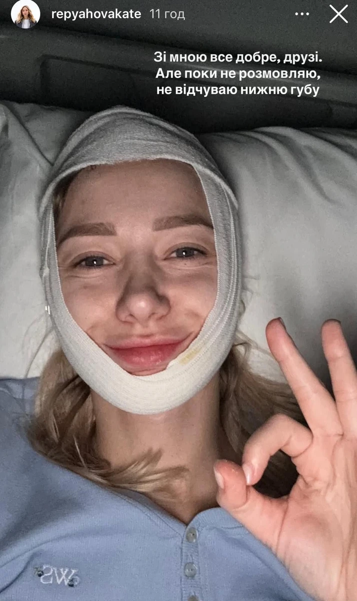 Катерина Репяхова зробила пластику підборіддя