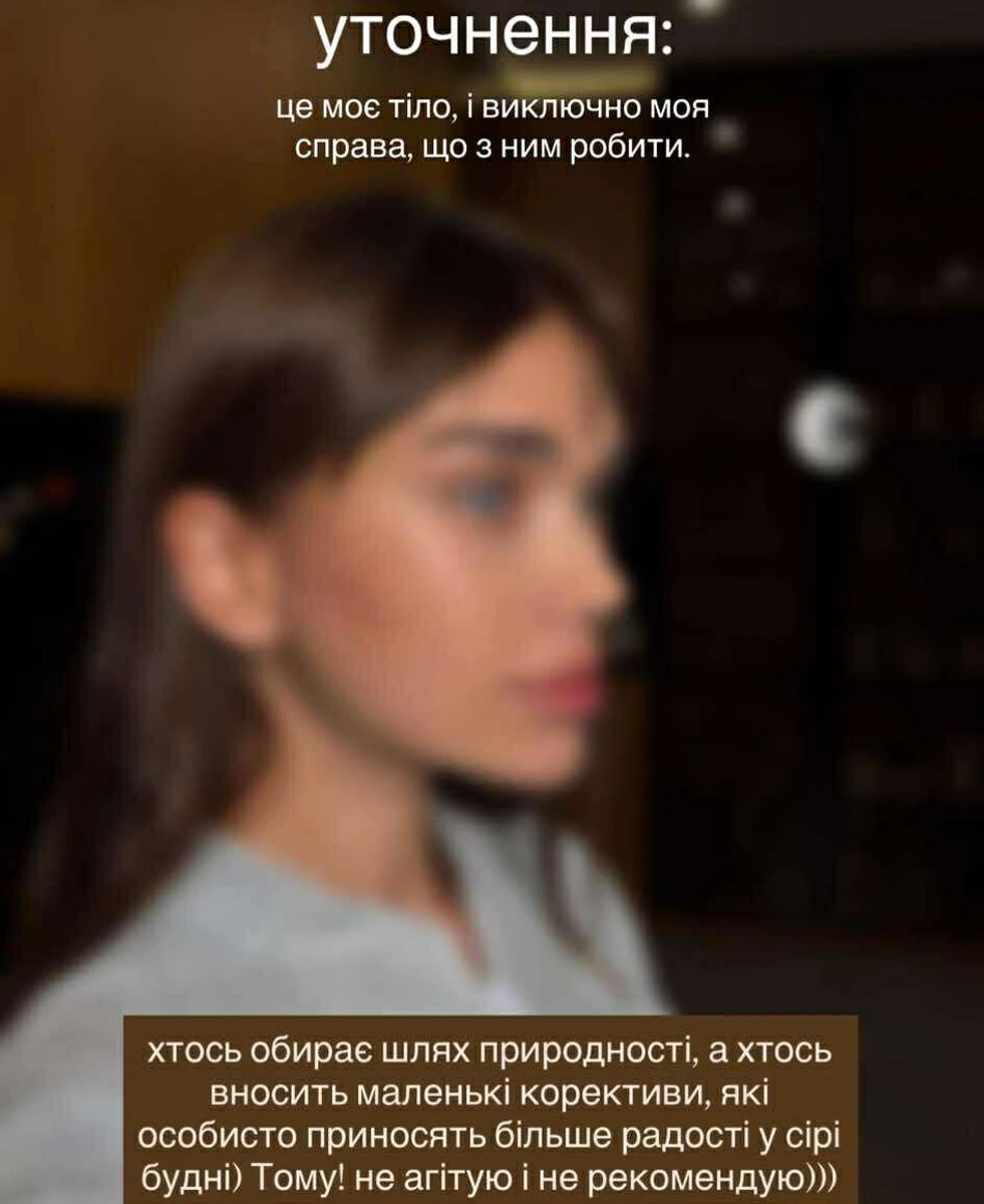 Саша Бо зробила підтяжку обличчя і розповіла про реабілітацію