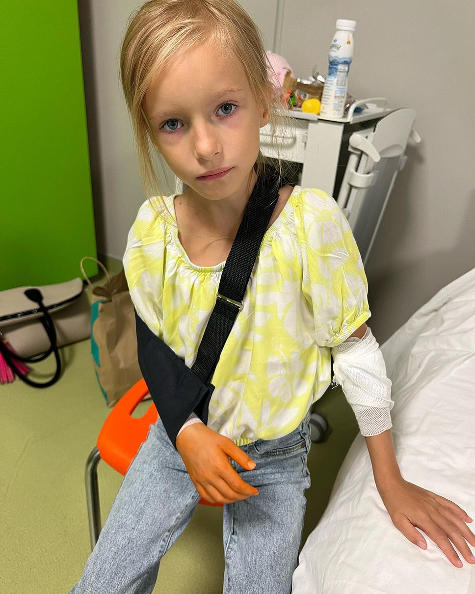 7-річна Катя одразу після операції