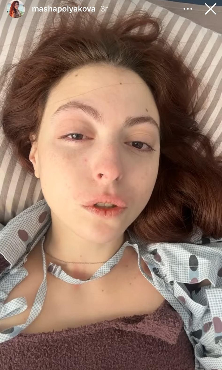 А це Маша вже після оперативного втручання