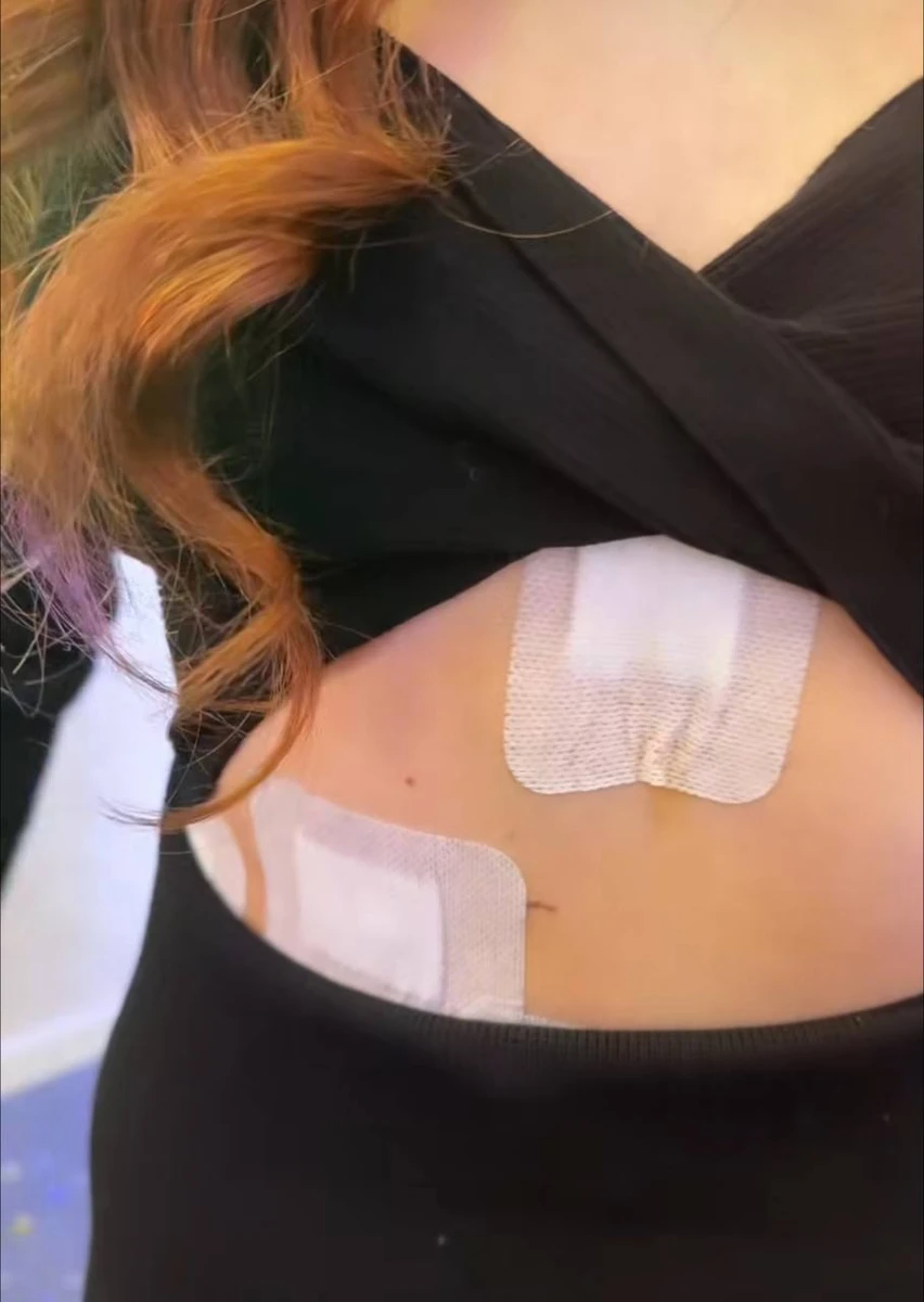 До речі, через що саме відбулося хірургічне втручання Маша так і не розповіла