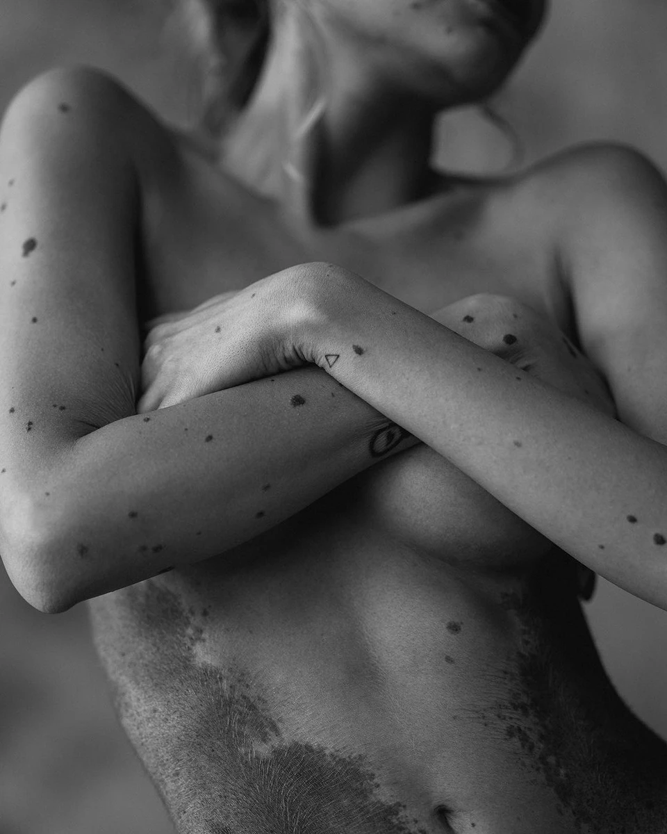 Юліанна знає та відчуває кожну свою родимку 