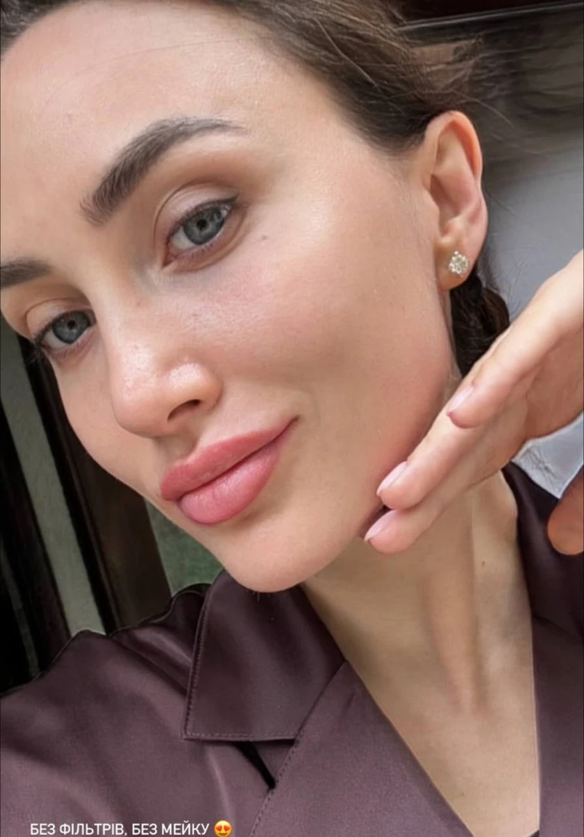 Ганна Різатдінова показала обличчя без фільтрів