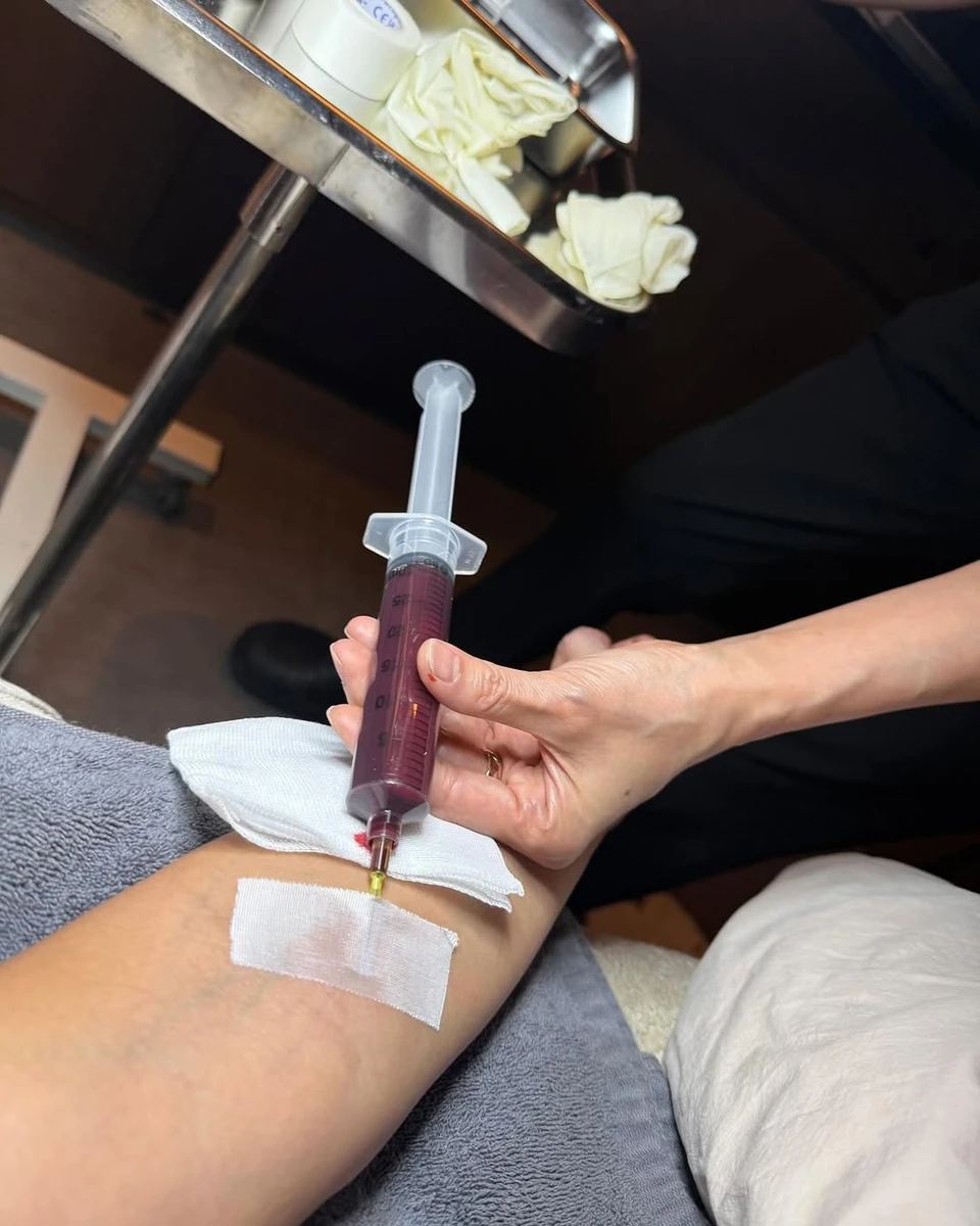 Кім Кардашян здивувала ін'єкцією невідомої речовини в руку