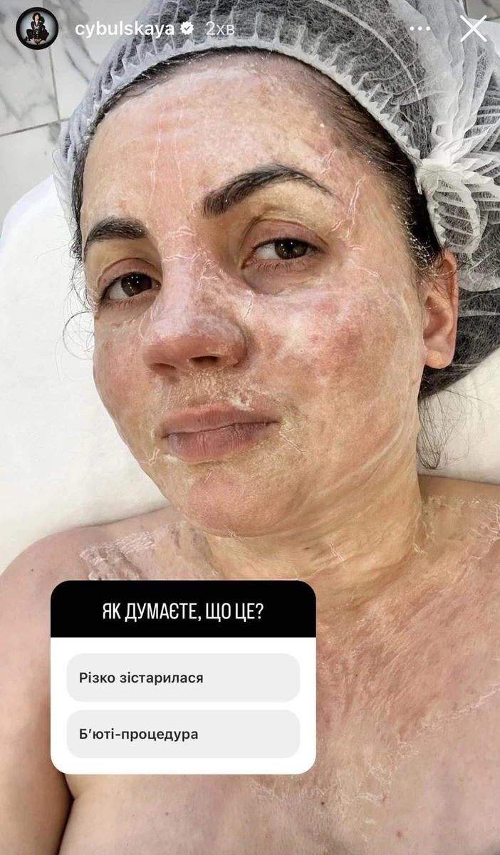 Співачка віддалася в руки б'юті-фахівця