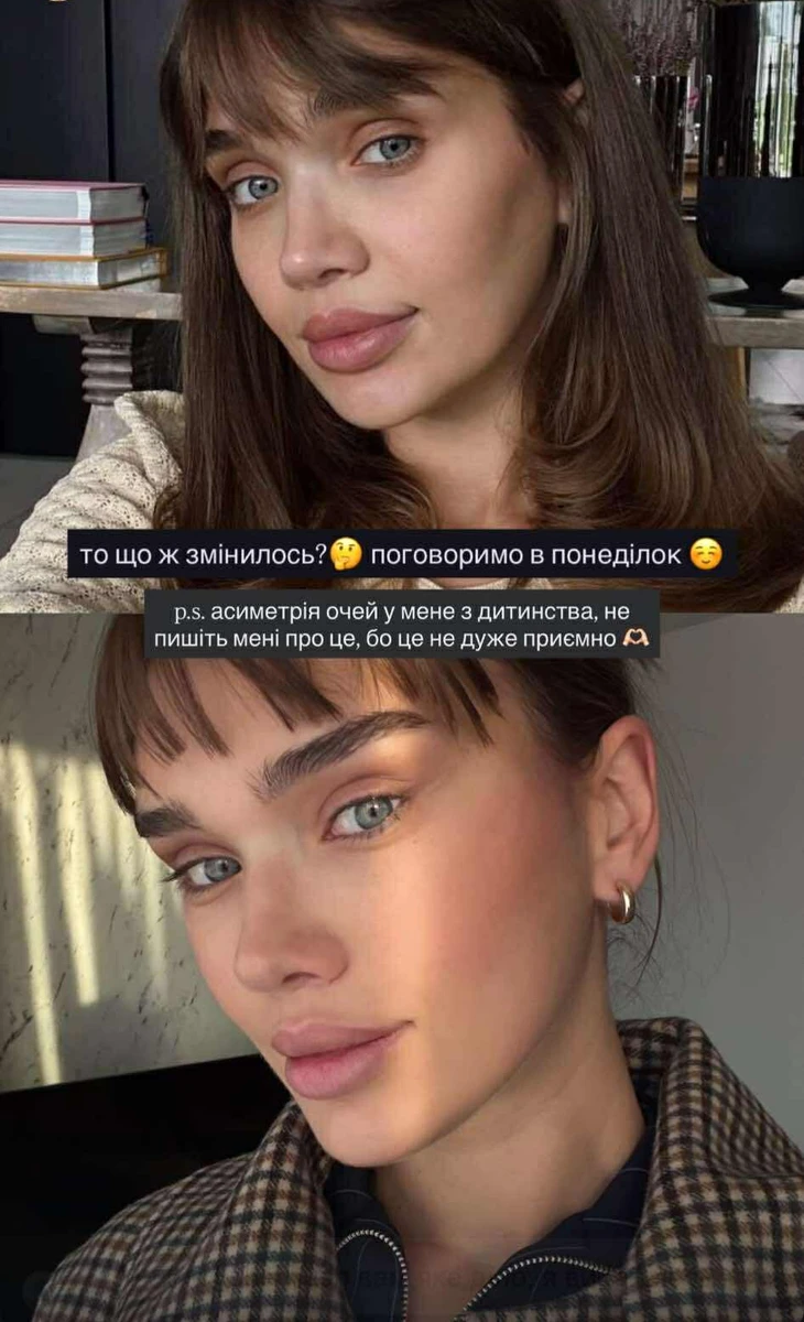 Саша Бо пояснила, чому її очі виглядали по іншому після підтяжки обличчя