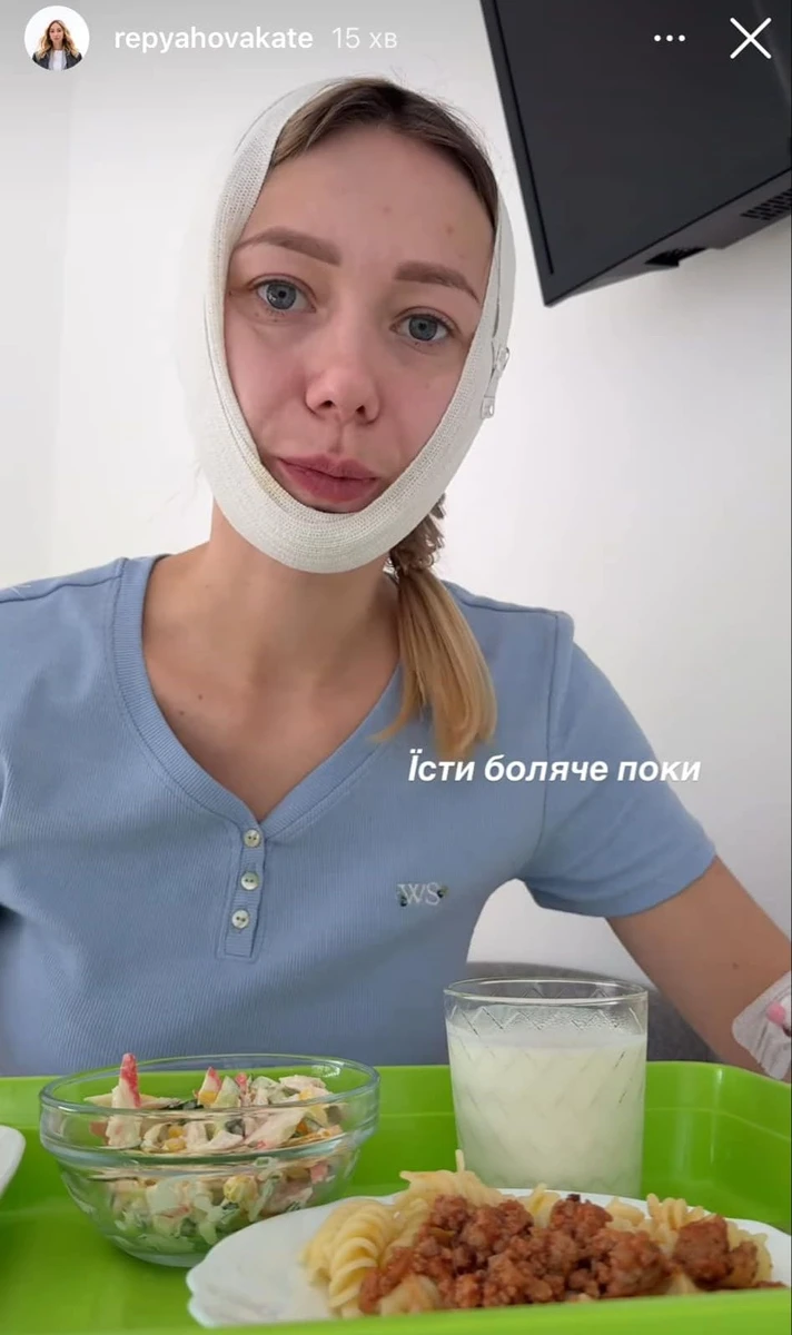 Дружина Віктора Павліка після пластики