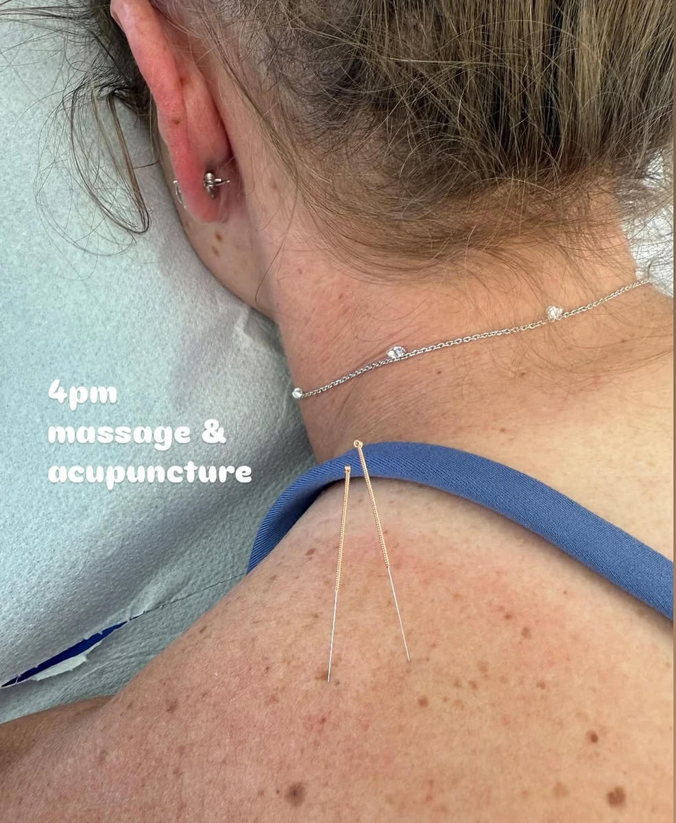 Еліна Світоліна показала, як їй вводять голки у тіло