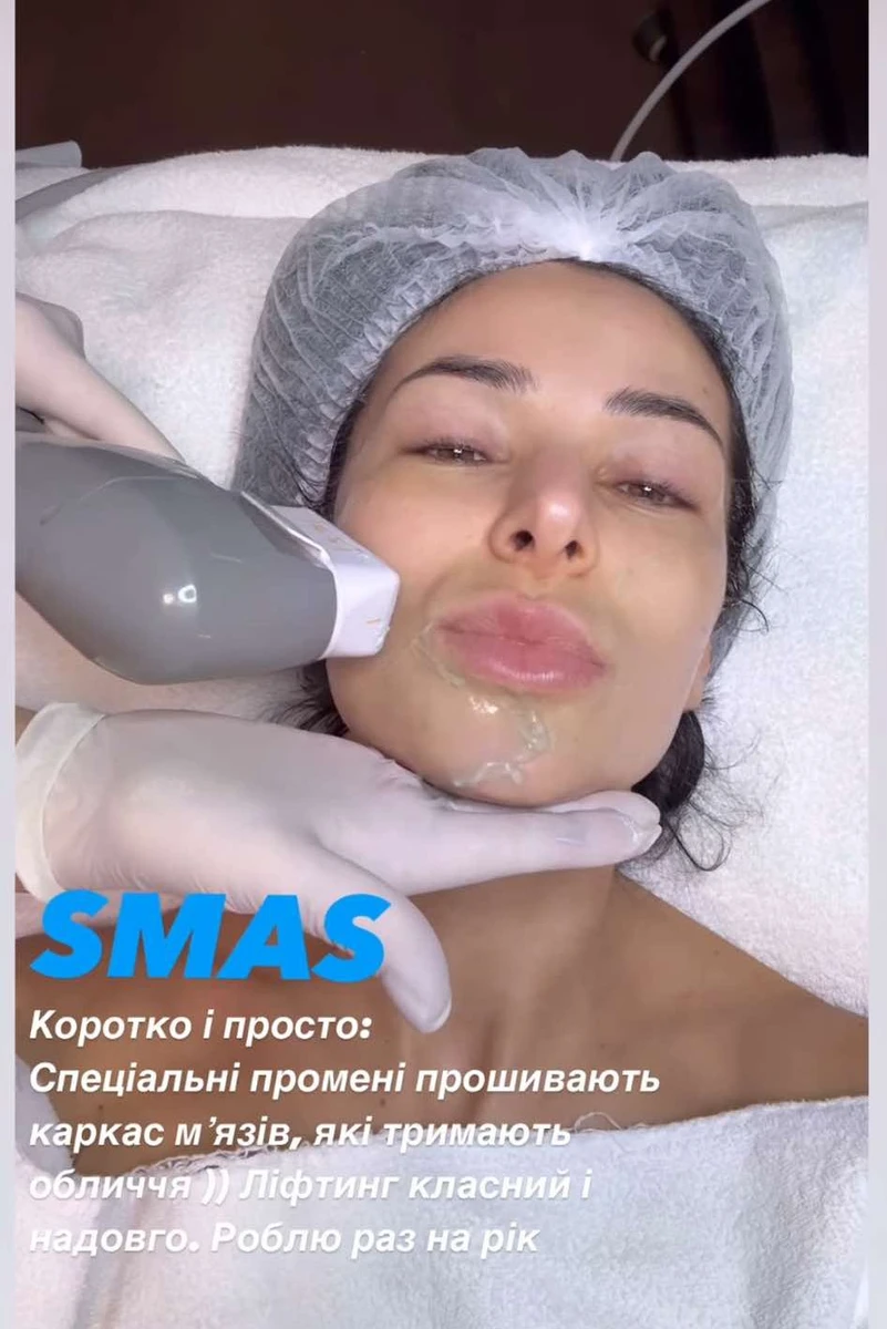 Злата Огнєвіч на ліфтингу у косметолога
