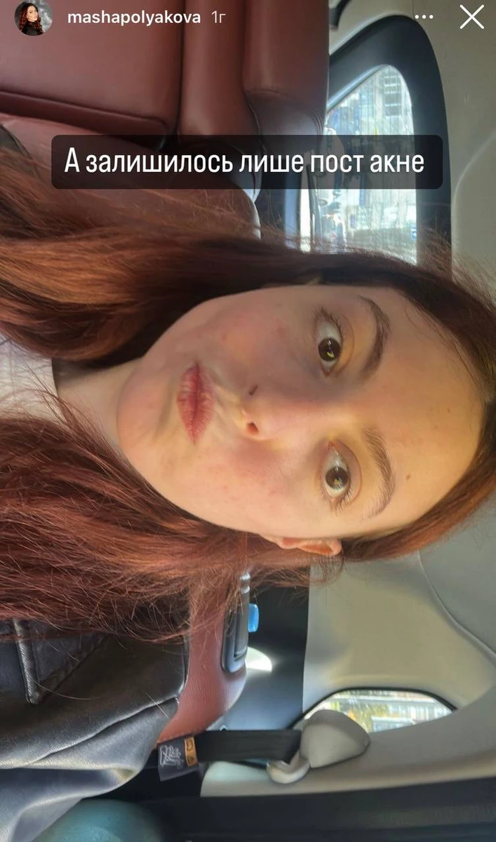 Дівчина наважилася викласти чесні фото в соцмережі