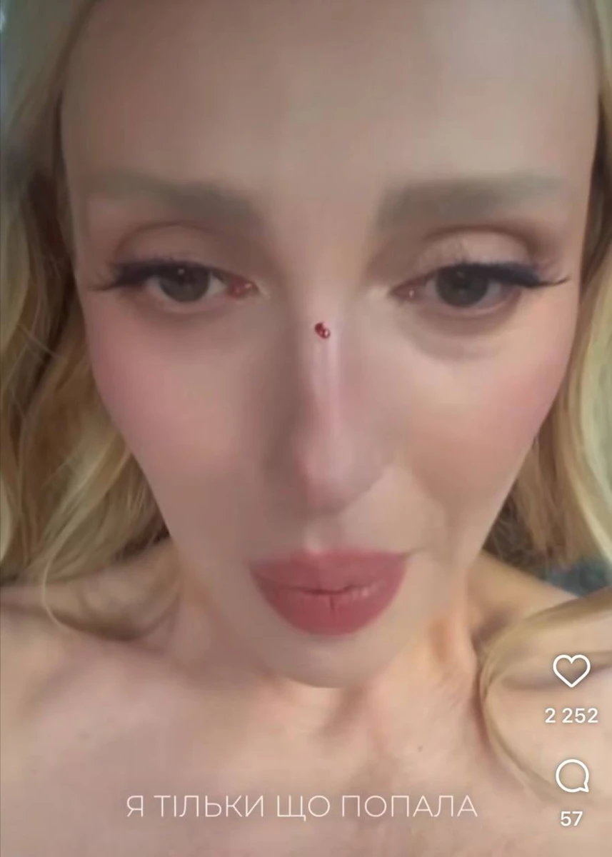 Полякова потрапила у аварію