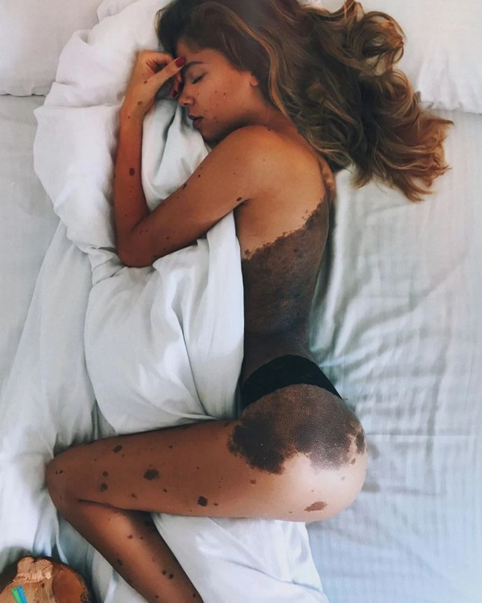 З цього фото Юліанна почала розповідати свою історію в Instagram