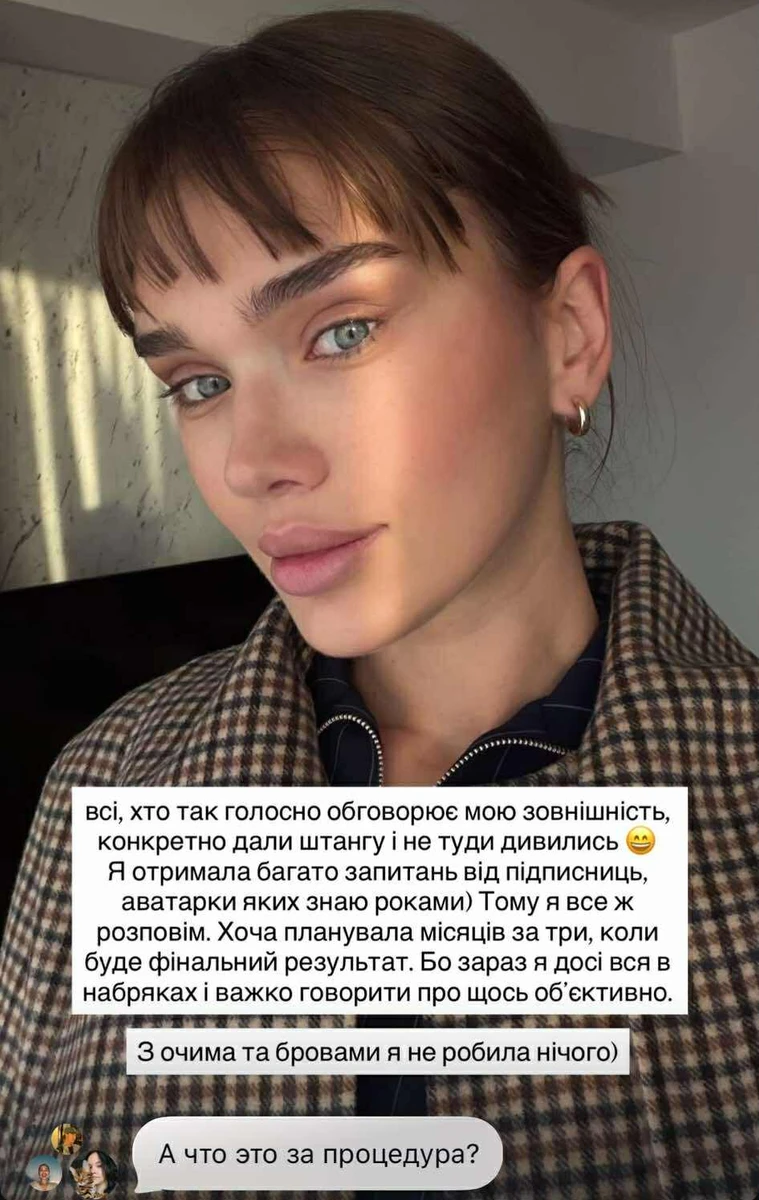 Саша Бо проходить через реабілітацію після підтяжки обличчя