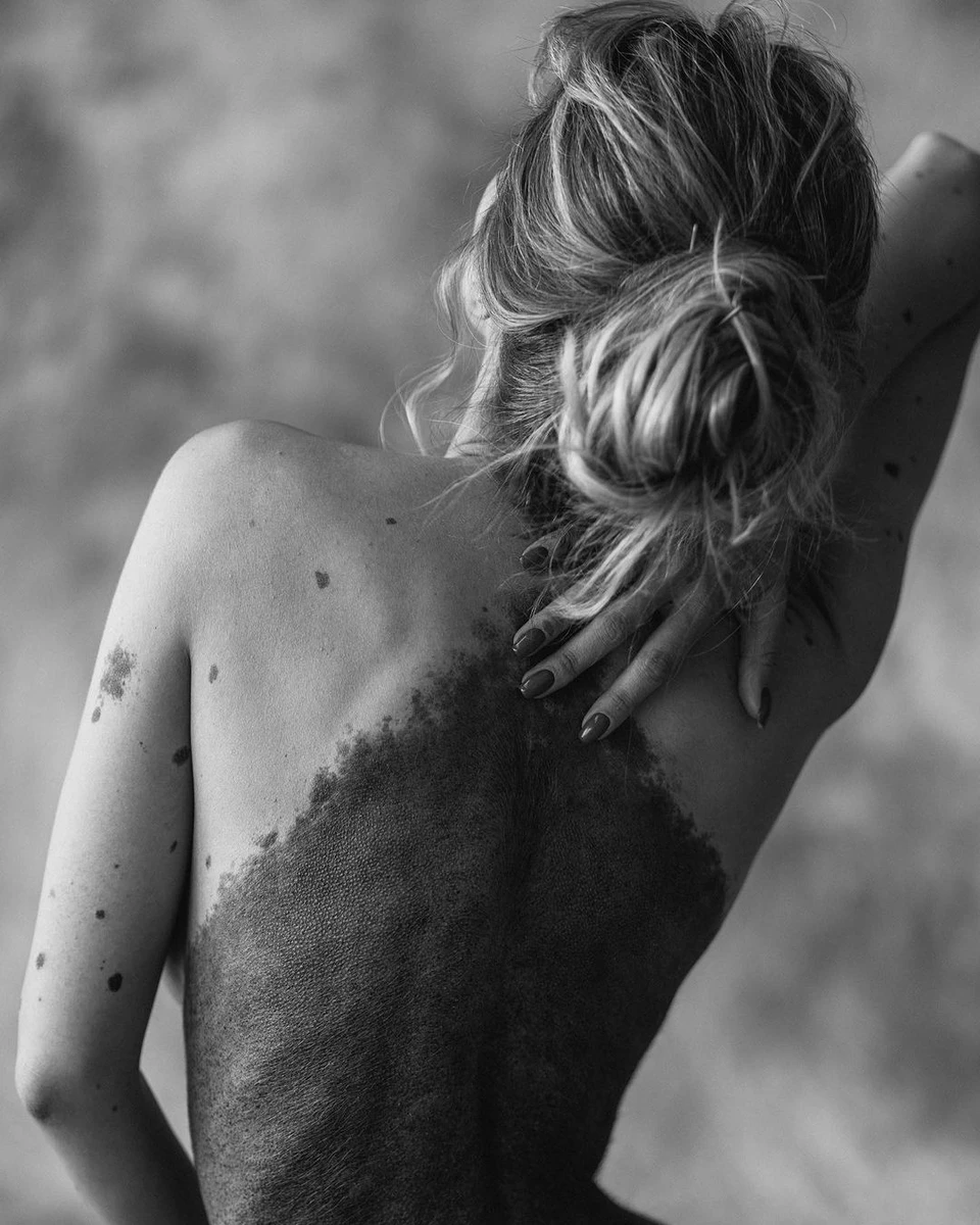 У житті Юссеф було кілька моментів, коли вона не хотіла виходити з дому, але вона змогла це пережити та полюбити себе