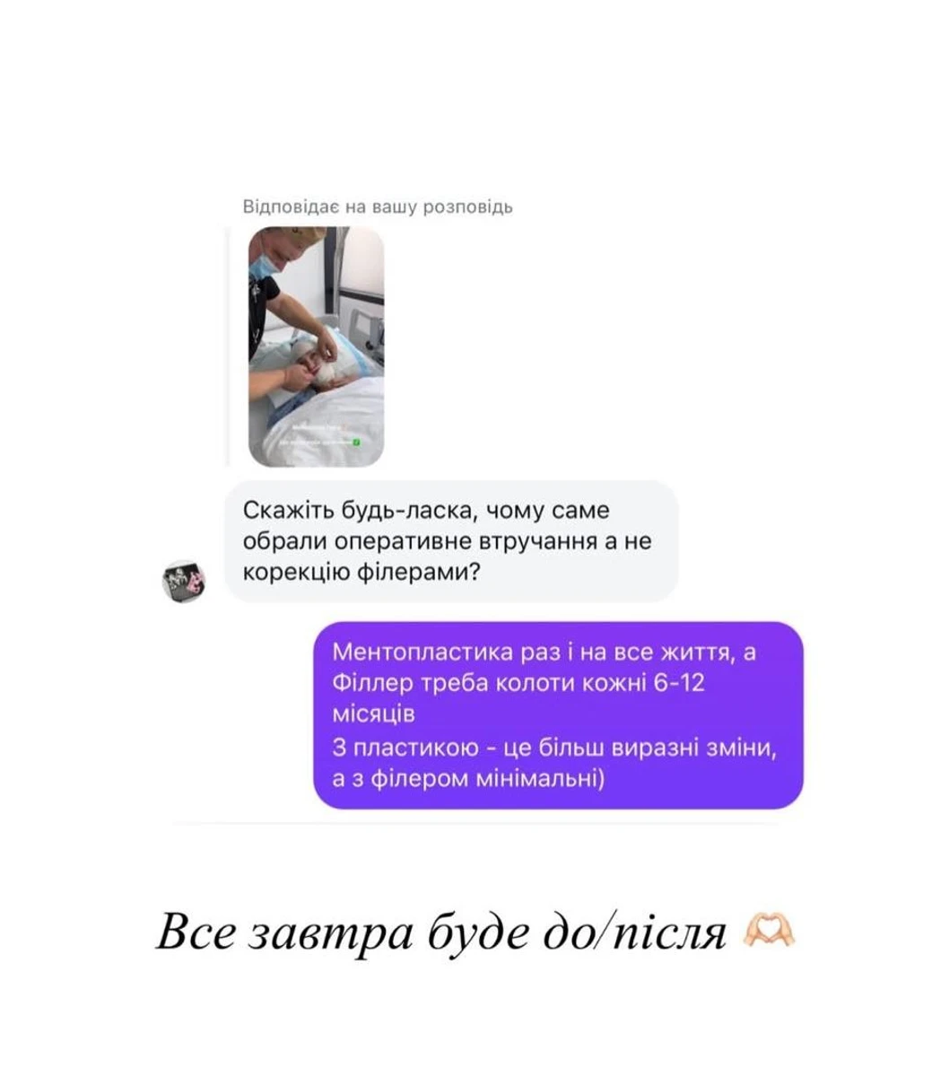 Рік тому Катя пробувала корекцію підборіддя філерами і називала це дивом 