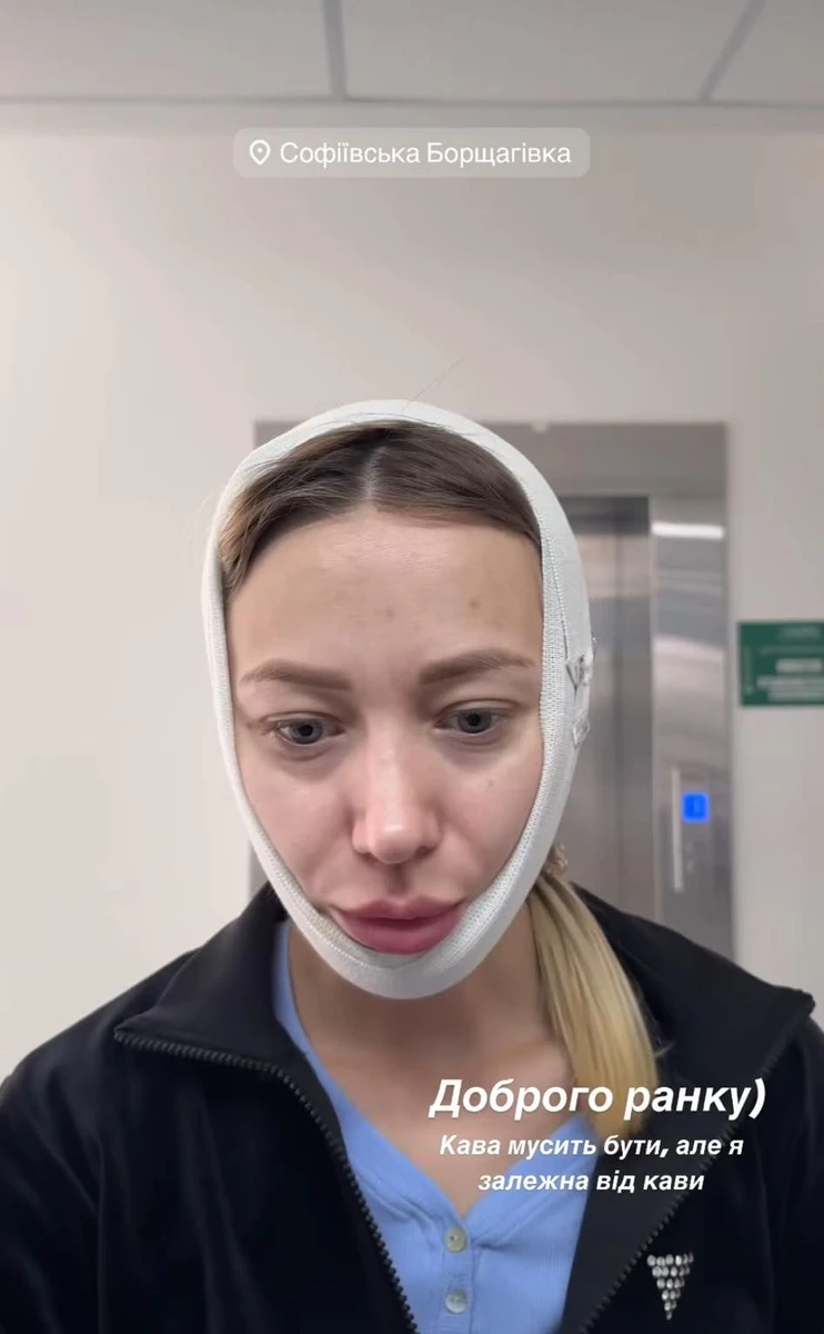 Всі чекають на фото після зняття пов'язки 