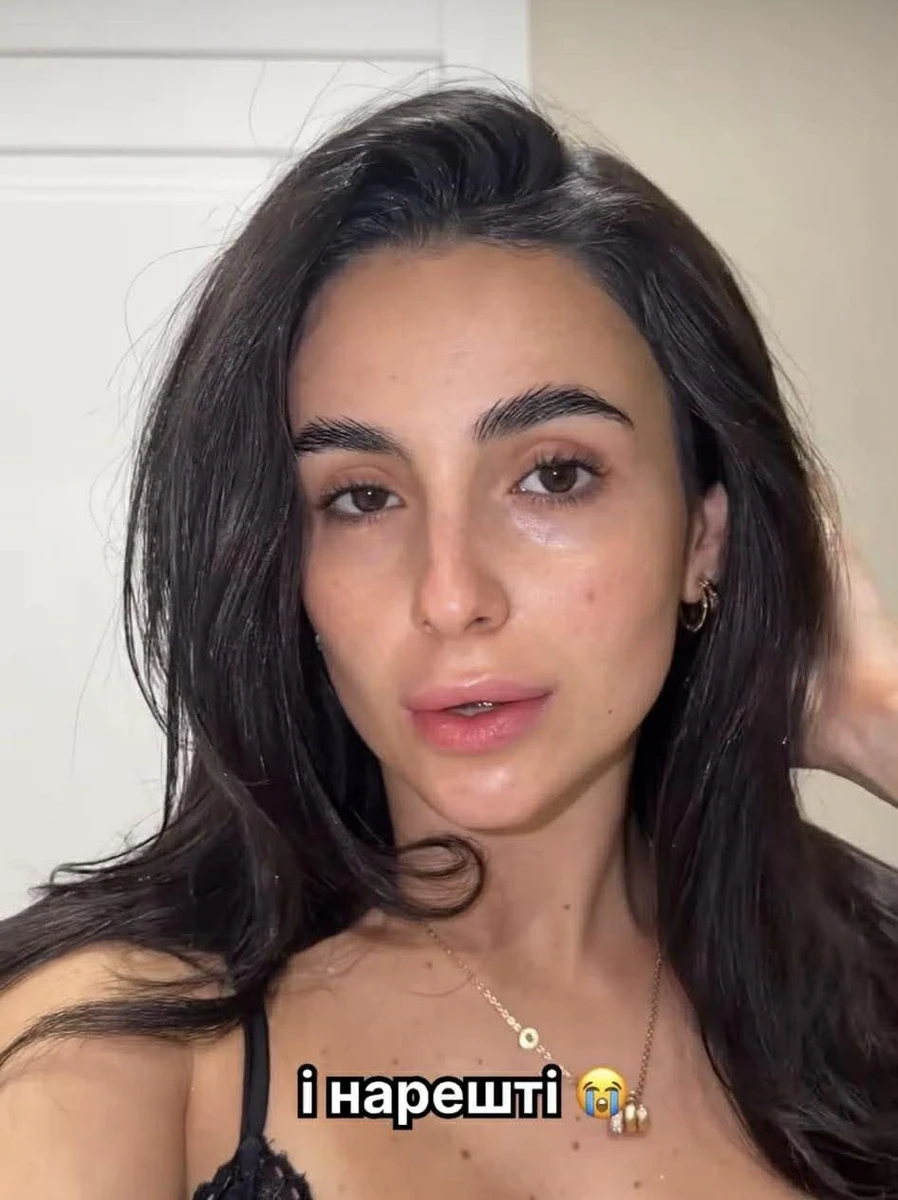 Трінчер про лікування акне