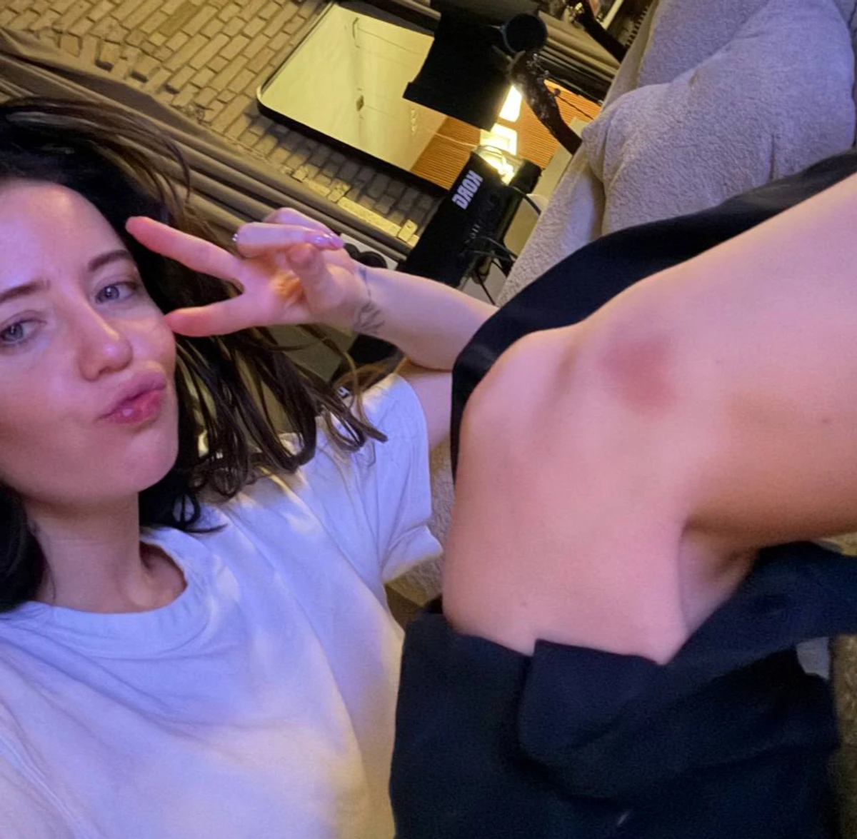 Надя Дорофєєва наробила фото з синцями на тілі