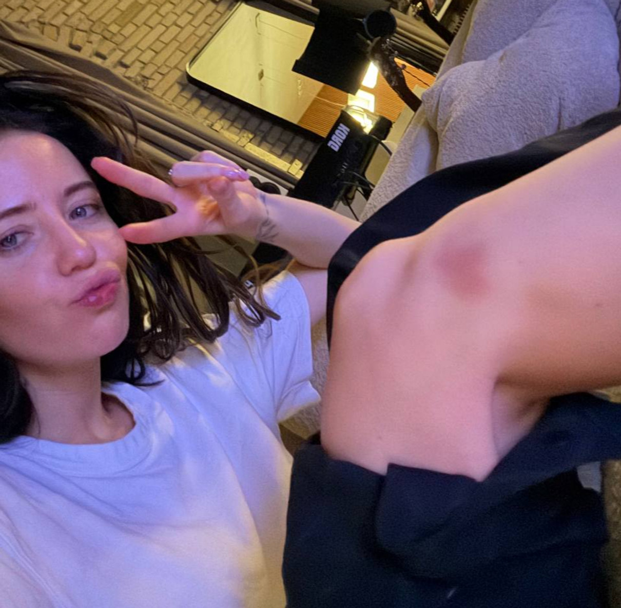 Надя Дорофєєва наробила фото з синцями на тілі