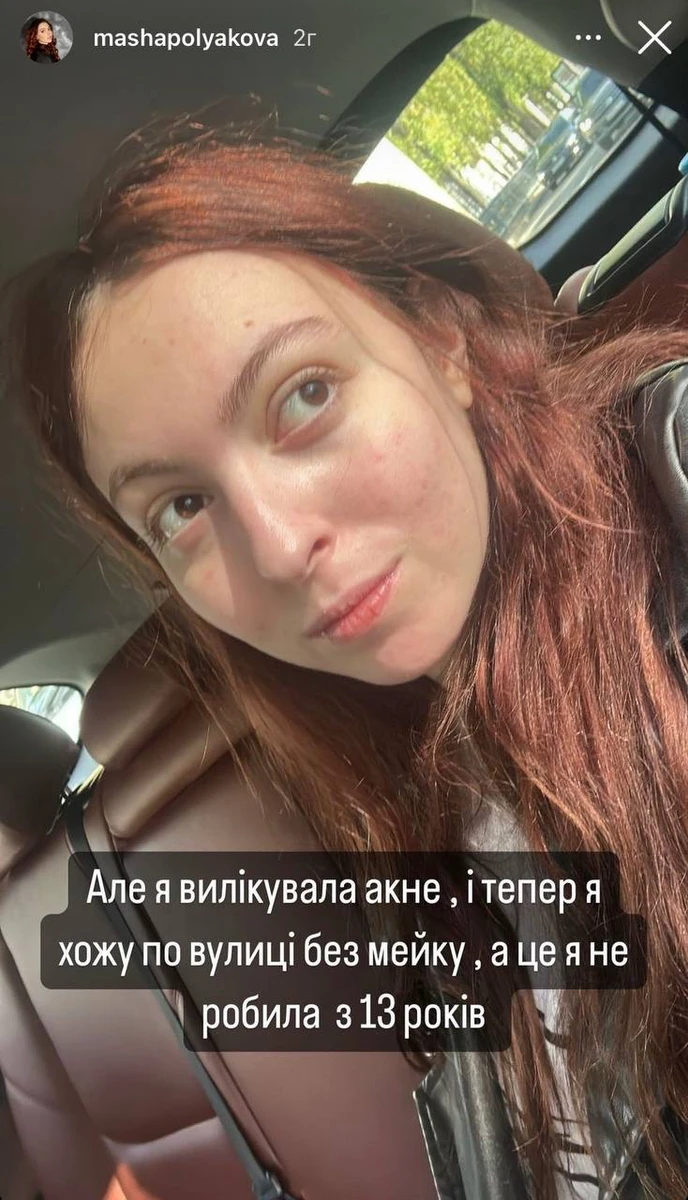 Полякова зізналася, що з 13 років постійно фарбується 