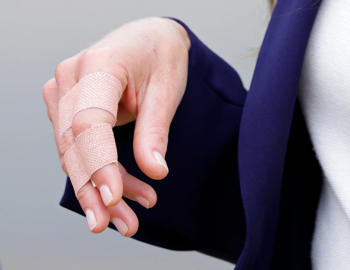 Палац переконує, що це лише забій після ігор з дітьми