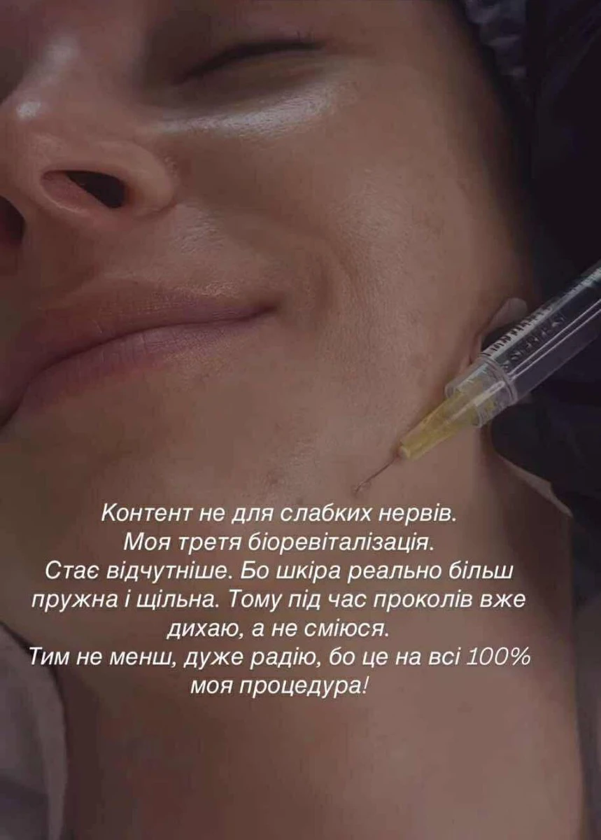 Мірошниченко показала обличчя зблизька