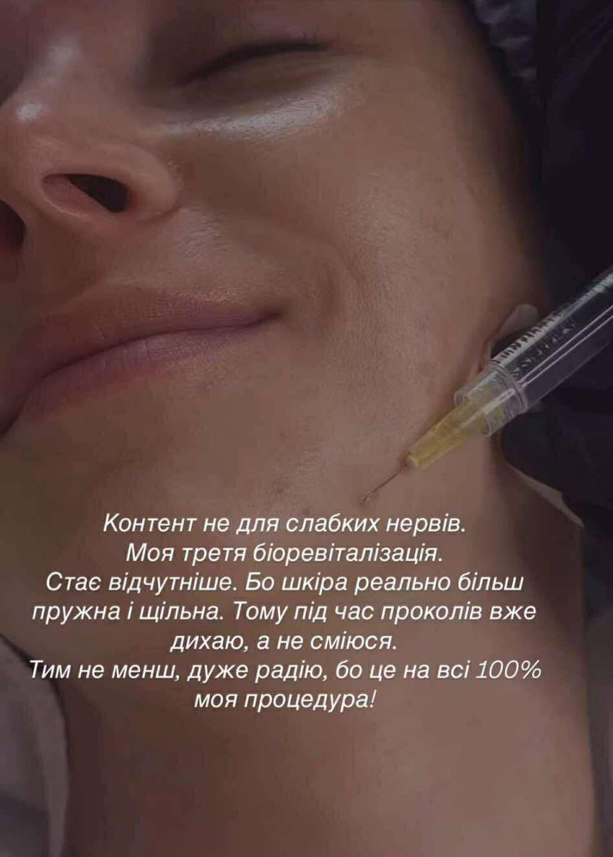 Мірошниченко показала обличчя зблизька