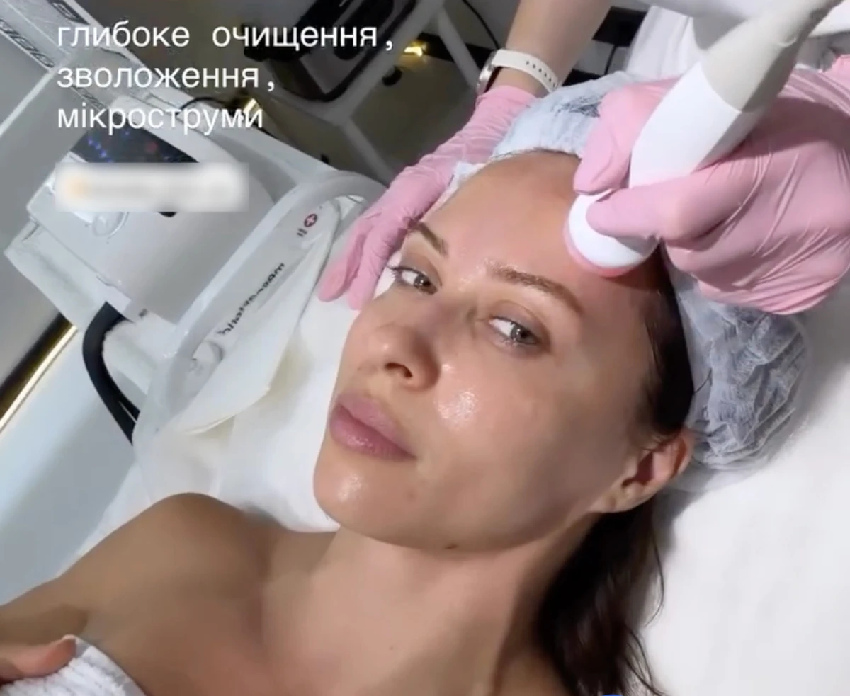 Вікторія Маремуха показала, що зробила з обличчям у косметолога