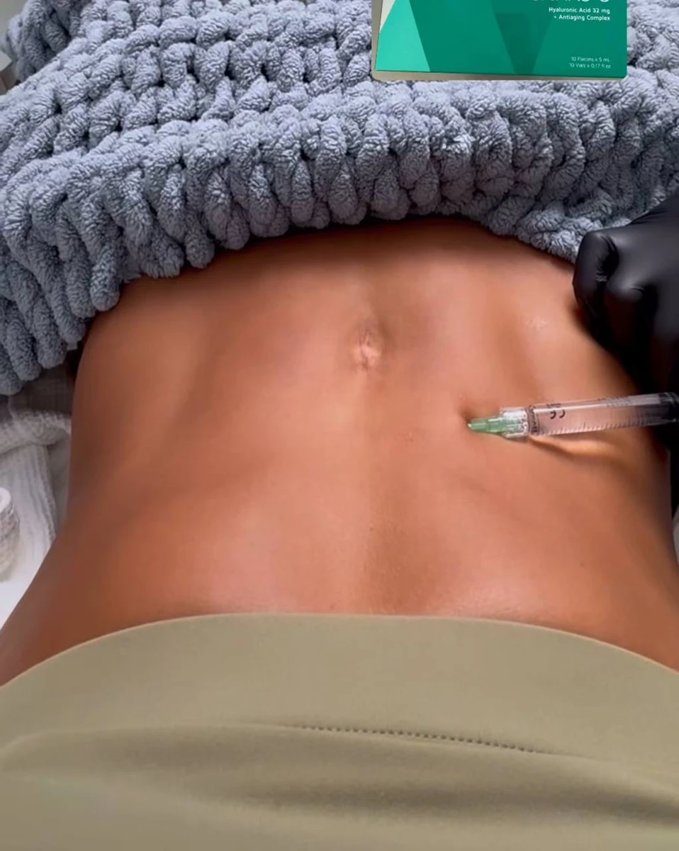 Прес Дімопулос