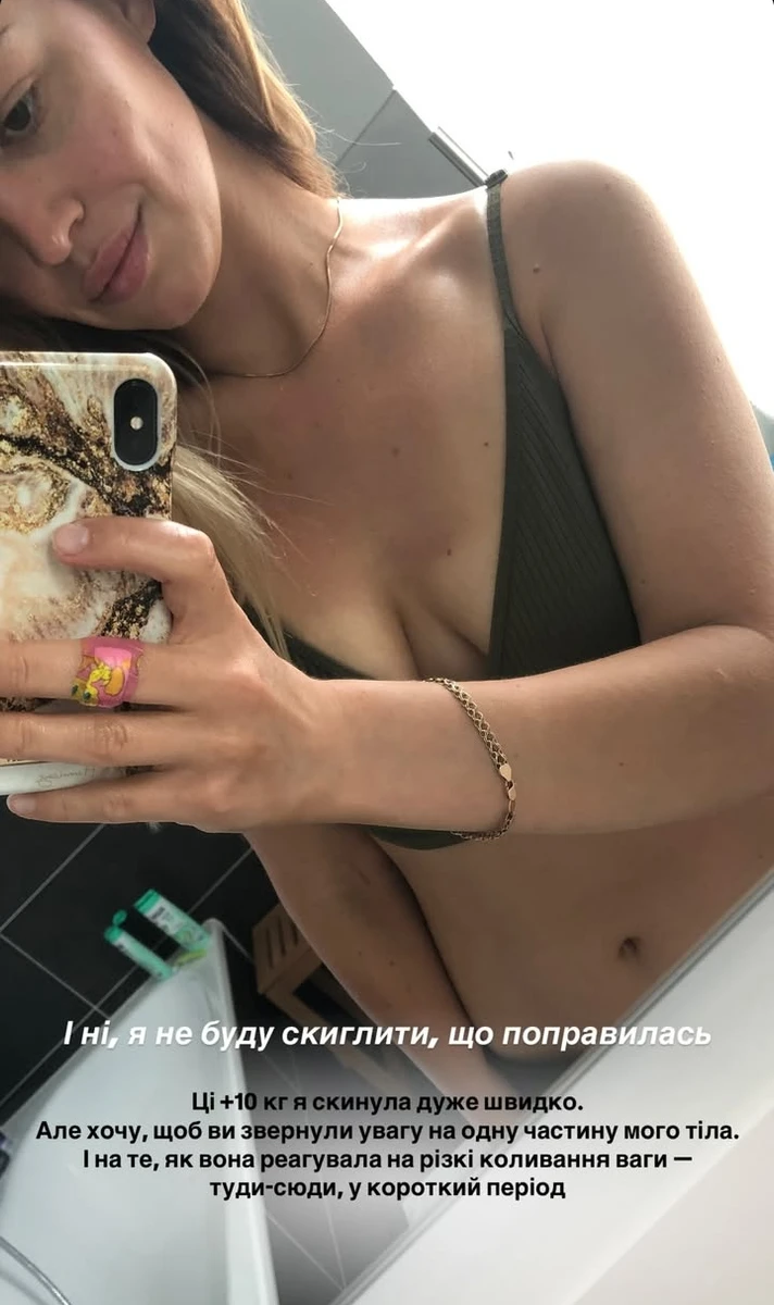 Бєлєнь з Холостяка-13 показала свої груди перед підтяжкою