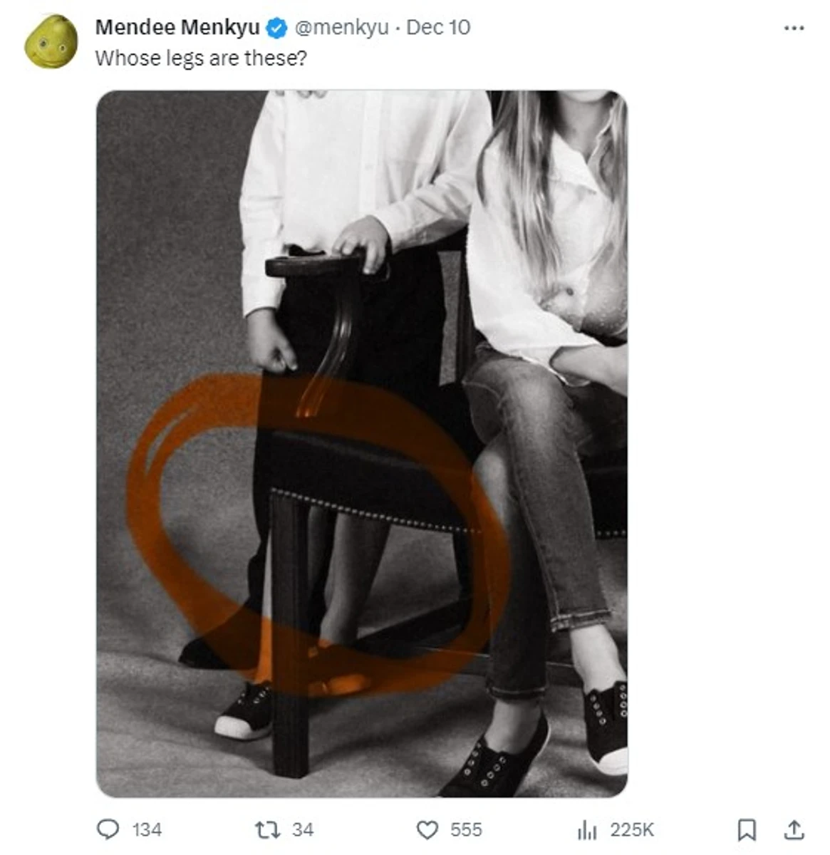 Тут у Луї вгледіли зайву ногу