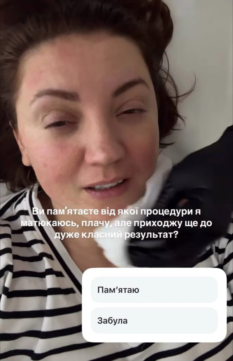 Оля Цибульська про терапію для обличчя