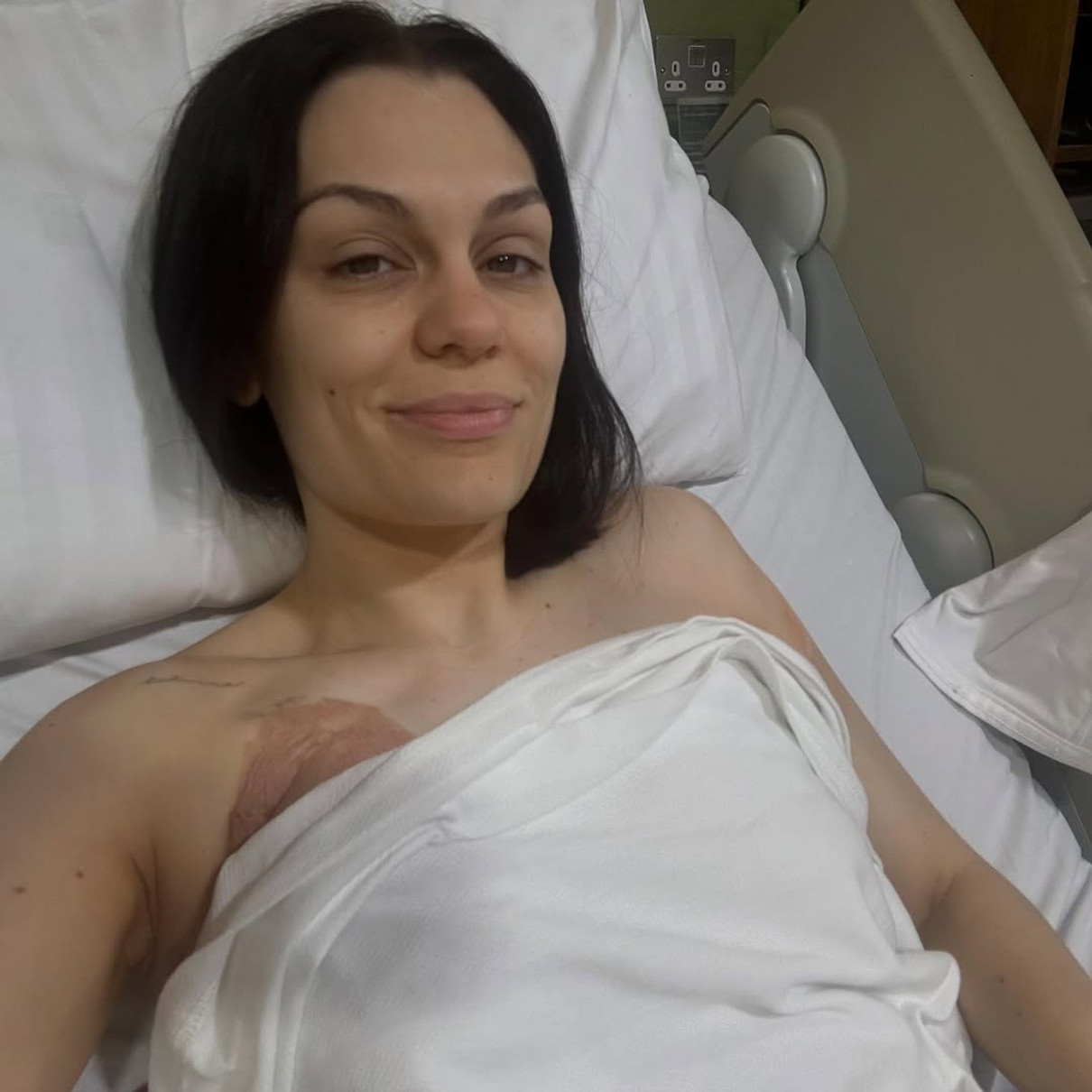 Джессі Джей показалася на операції через рак грудей