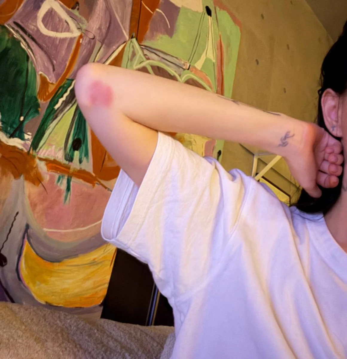 Надя Дорофєєва зняла синці на своєму тілі і назвала їхню причину