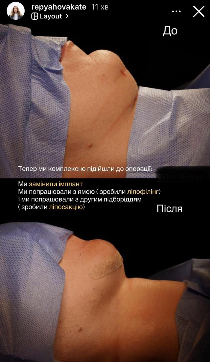 Репяхова в інстаграм