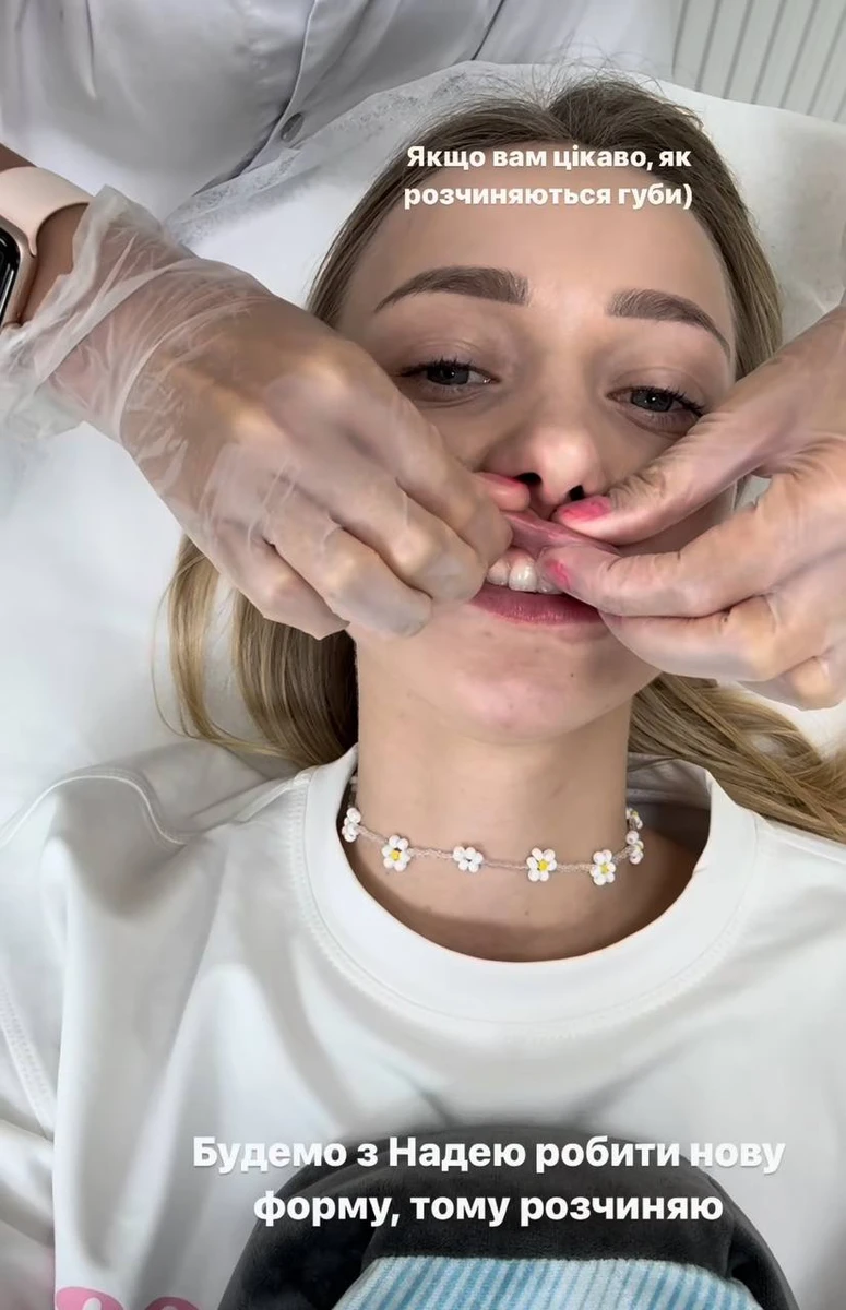 До речі, щоб зробити бажану форму Каті необхідно буде почекати хоча б кілька тижнів